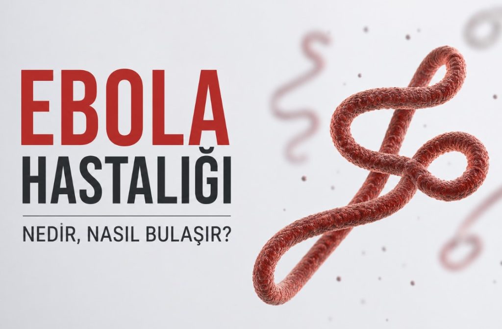 Ebola Hastalığı Nedir, Nasıl Bulaşır?